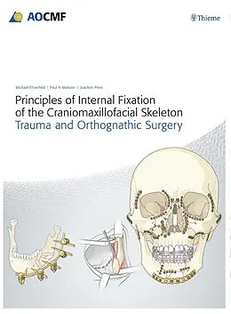 E-Book (pdf) Principles of Internal Fixation of the Craniomaxillofacial Skeleton von Joachim Prein, Michael Ehrenfeld, Paul N. Manson