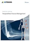 E-Book (pdf) Periprosthetic Fracture Management von Michael Schütz, Carsten Perka