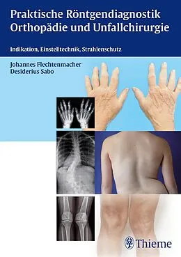 E-Book (pdf) Praktische Röntgendiagnostik Orthopädie und Unfallchirurgie von Gabriele Angenendt, Ursula Schütze-Kreilkamp, Volker Tschuschke