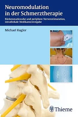 E-Book (pdf) Neuromodulation in der Schmerztherapie von Michael Kugler