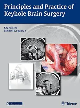 E-Book (pdf) Principles and Practice of Keyhole Brain Surgery von Charles Teo, Michael E. Sughrue