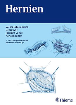 E-Book (epub) Hernien von Volker Schumpelick, Georg Arlt, Klaus Joachim Conze