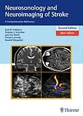 E-Book (pdf) Neurosonology and Neuroimaging of Stroke von José Manuel Valdueza, Stephan Schreiber, Jens-Eric Röhl
