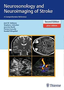 E-Book (pdf) Neurosonology and Neuroimaging of Stroke von José Manuel Valdueza, Stephan Schreiber, Jens-Eric Röhl