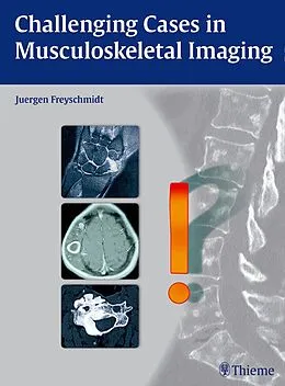 E-Book (pdf) Challenging Cases in Musculoskeletal Imaging von Jürgen Freyschmidt