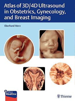 Livre Relié Atlas of 3D/4D Ultrasound in Obstetrics, Gynecology, and Breast Imaging de Eberhard Merz