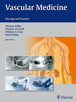 E-Book (pdf) Vascular Medicine von Thomas Zeller, Thomas Cissarek, William Gray