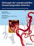 E-Book (pdf) Chirurgie der extrakraniellen hirnversorgenden Arterien von Hans Scholz, Matthias Wunsch