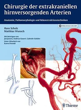 E-Book (epub) Chirurgie der extrakraniellen hirnversorgenden Arterien von Hans Scholz, Matthias Wunsch
