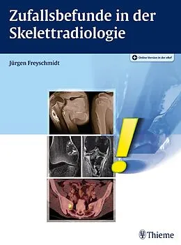 E-Book (pdf) Zufallsbefunde in der Skelettradiologie von Jürgen Freyschmidt