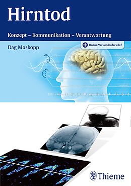 E-Book (pdf) Hirntod von Dag Moskopp