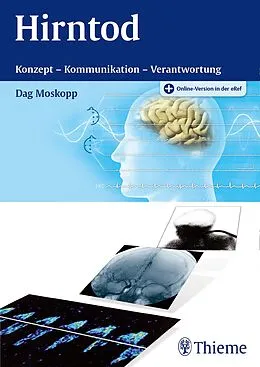 E-Book (epub) Hirntod von Dag Moskopp