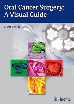 E-Book (pdf) Oral Cancer Surgery von Marco Kesting