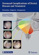 Fester Einband Sinonasal Complications of Dental Disease and Treatment von Giovanni Felisati, Matteo Chiapasco