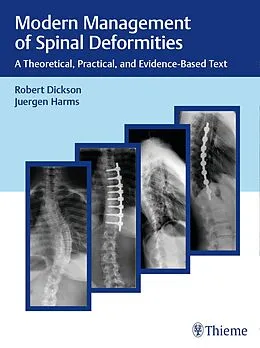 E-Book (pdf) Modern Management of Spinal Deformities von Robert A. Dickson, Jürgen Harms