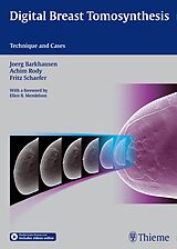 Livre Relié Digital Breast Tomosynthesis de Jörg Barkhausen, Joerg Barkhausen, Achim Rody