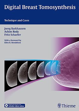 Livre Relié Digital Breast Tomosynthesis de Jörg Barkhausen, Joerg Barkhausen, Achim Rody