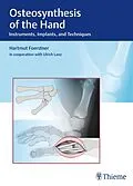 E-Book (pdf) Osteosynthesis of the Hand von Hartmut Förstner