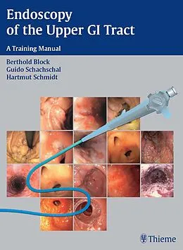 E-Book (pdf) Endoscopy of the Upper GI Tract von Berthold Block, Guido Schachschal, Hartmut H. -J. Schmidt