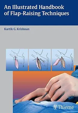 E-Book (pdf) An Illustrated Handbook of Flap-Raising Techniques von Kartik G. Krishnan