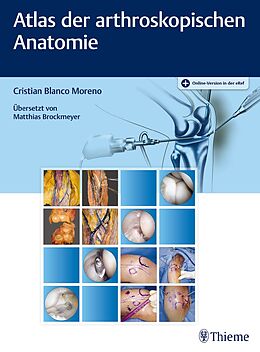 Set mit div. Artikeln (Set) Atlas der arthroskopischen Anatomie von Cristian Blanco Moreno