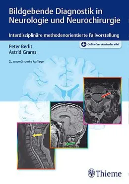 E-Book (pdf) Bildgebende Diagnostik in Neurologie und Neurochirurgie von Peter-Dirk Berlit, Astrid E. Grams