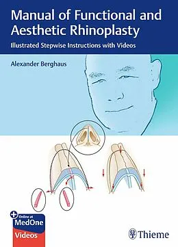 E-Book (pdf) Manual of Functional and Aesthetic Rhinoplasty von Alexander Berghaus