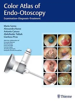 E-Book (pdf) Color Atlas of Endo-Otoscopy von Mario Sanna, Alessandra Russo, Antonio Caruso