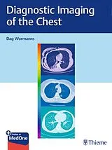 Set mit div. Artikeln (Set) Diagnostic Imaging of the Chest von Dag Wormanns