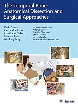 E-Book (pdf) The Temporal Bone von Mario Sanna, Alessandra Russo, Abdelkader Taibah
