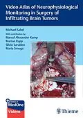 E-Book (pdf) Video Atlas of Neurophysiological Monitoring in Surgery of Infiltrating Brain Tumors von Michael Christoph Sabel