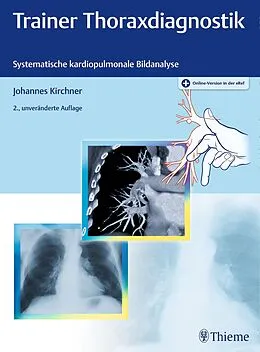 E-Book (pdf) Trainer Thoraxdiagnostik von Johannes Kirchner