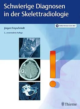 E-Book (pdf) Schwierige Diagnosen in der Skelettradiologie von Jürgen Freyschmidt