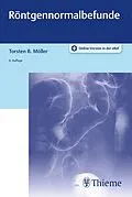 E-Book (pdf) Röntgennormalbefunde von Torsten Bert Möller
