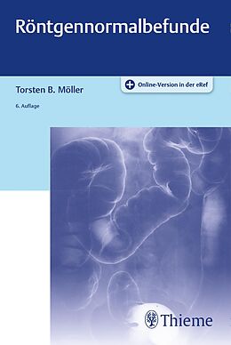 E-Book (pdf) Röntgennormalbefunde von Torsten Bert Möller