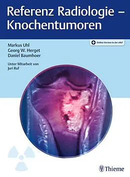 E-Book (pdf) Referenz Radiologie - Knochentumoren von Markus Uhl, Georg W. Herget, Daniel Baumhoer