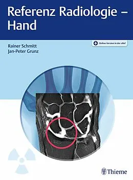 E-Book (pdf) Referenz Radiologie - Hand von Rainer Schmitt, Jan-Peter Grunz
