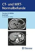 E-Book (pdf) CT und MRT Normalbefunde von Torsten Bert Möller, Emil Reif