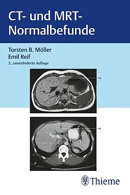E-Book (pdf) CT und MRT Normalbefunde von Torsten Bert Möller, Emil Reif