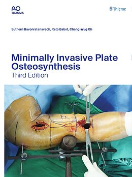 eBook (pdf) Minimally Invasive Plate Osteosynthesis de Suthorn Bavonratanavech, Reto Babst, Chang-Wug Oh