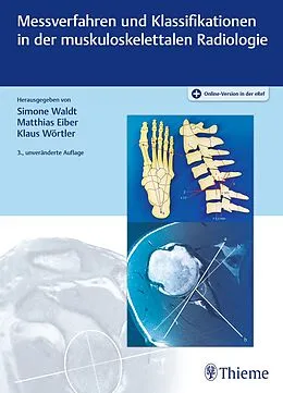 E-Book (epub) Messverfahren und Klassifikationen in der muskuloskelettalen Radiologie von Simone Waldt, Matthias Eiber, Klaus Wörtler