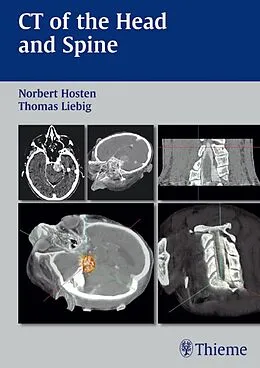 E-Book (epub) CT of the Head and Spine von Norbert Hosten, Thomas Liebig
