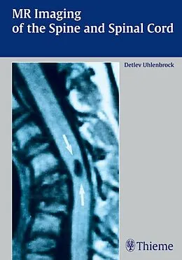 E-Book (epub) MR Imaging of the Spine and Spinal Cord von Detlev Uhlenbrock