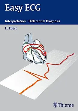 E-Book (epub) Easy ECG von Hans-Holger Ebert