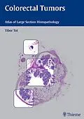 E-Book (epub) Colorectal Tumors von Tibor Tot