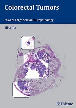 E-Book (epub) Colorectal Tumors von Tibor Tot