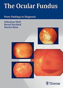 E-Book (epub) The Ocular Fundus von Sebastian Wolf, Martin Reim, Bernd Kirchhof