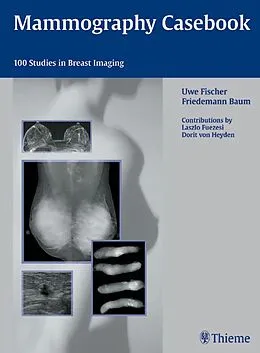 E-Book (epub) Mammography Casebook von Uwe Fischer