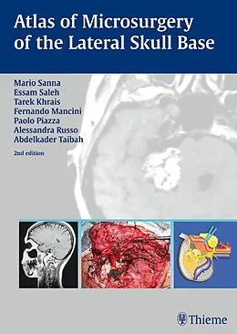 E-Book (epub) Atlas of Microsurgery of the Lateral Skull Base von Mario Sanna, Tarek Khrais, Fernando Mancini