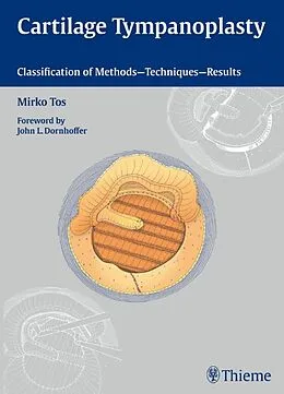 E-Book (epub) Cartilage Tympanoplasty von Mirko Tos